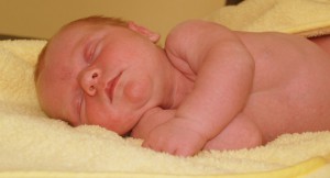 赤ちゃんの背中の湿疹を改善する方法！赤ちゃんの背中を救え