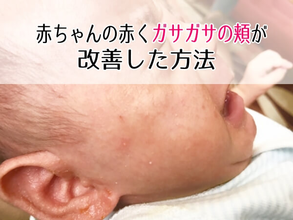赤ちゃんの赤くガサガサの頬にオーガニック保湿クリーム使用し改善